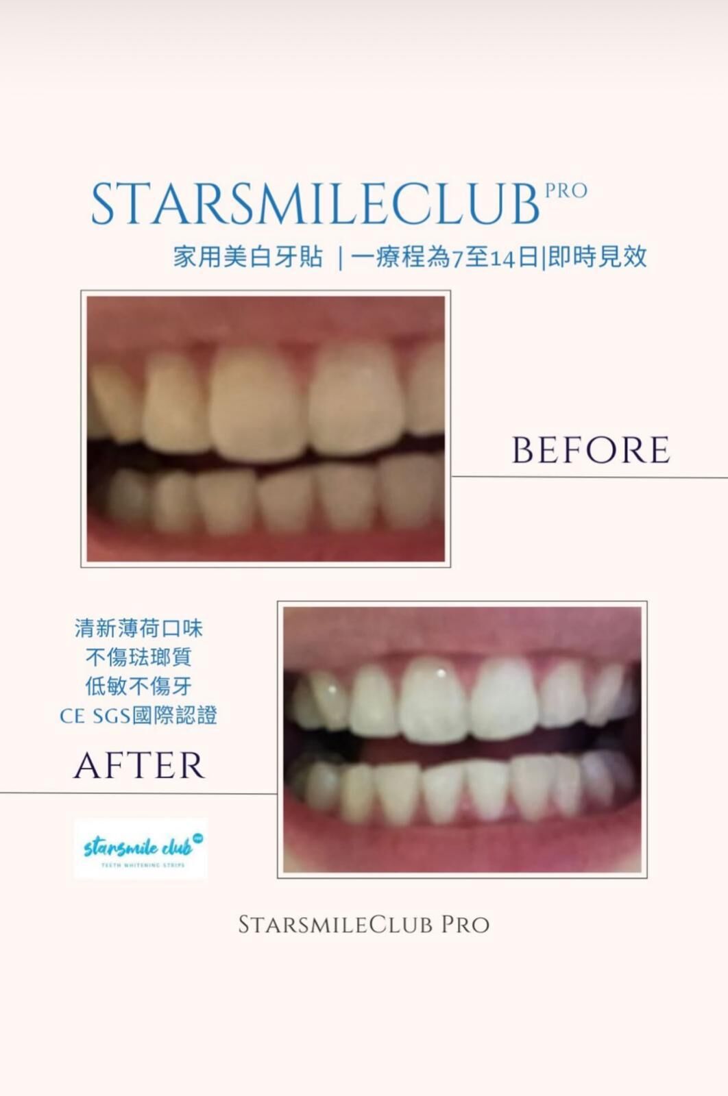 𝐒𝐭𝐚𝐫𝐬𝐦𝐢𝐥𝐞𝐂𝐥𝐮𝐛 𝐏𝐫𝐨 專業🇺🇸美白牙齒貼 （7p)