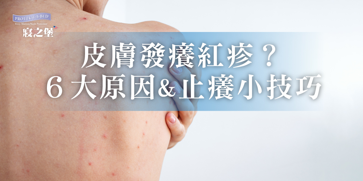 皮膚發癢紅疹6大原因,止癢小技巧