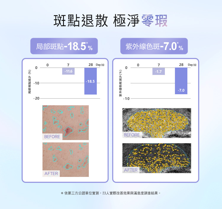 實測成果（28天使用數據）：  局部斑點：減少18.5%*。  紫外線色斑：減少7.0%*。  視覺對照：提供局部斑點與紫外線色斑使用前後（BEFORE/AFTER）的儀器檢測對比圖。