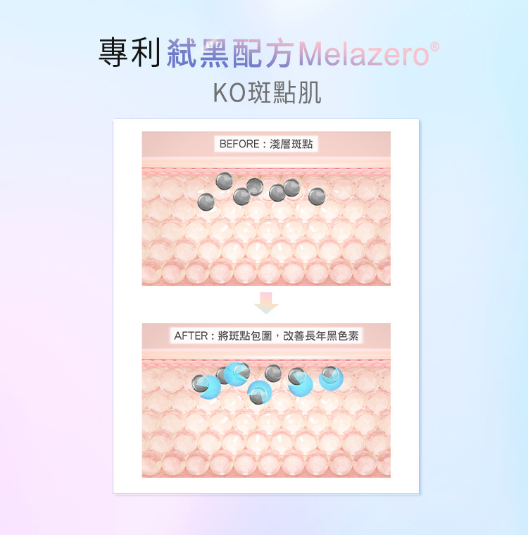 主題：專利弒黑配方Melazero®，KO斑點肌。  機轉說明：  BEFORE：淺層斑點。  AFTER：將斑點包圍，改善長年黑色素。