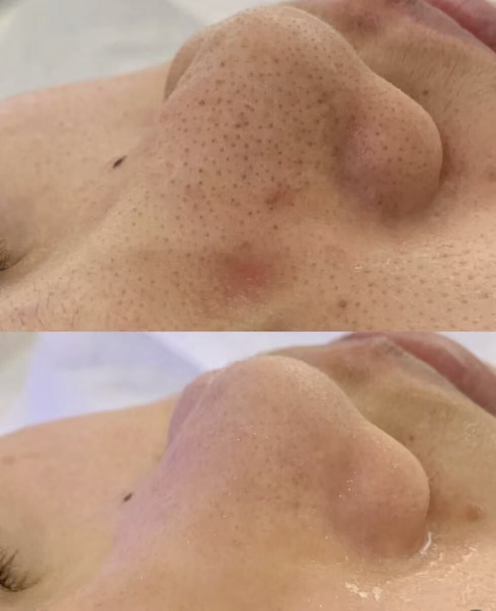 【預購】CERAVE H030501 「零毛孔」抗衰老視黃醇精華