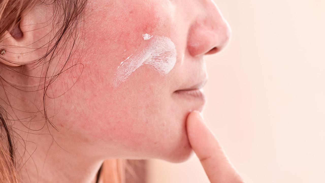 換季乾癢皮脂膜受損