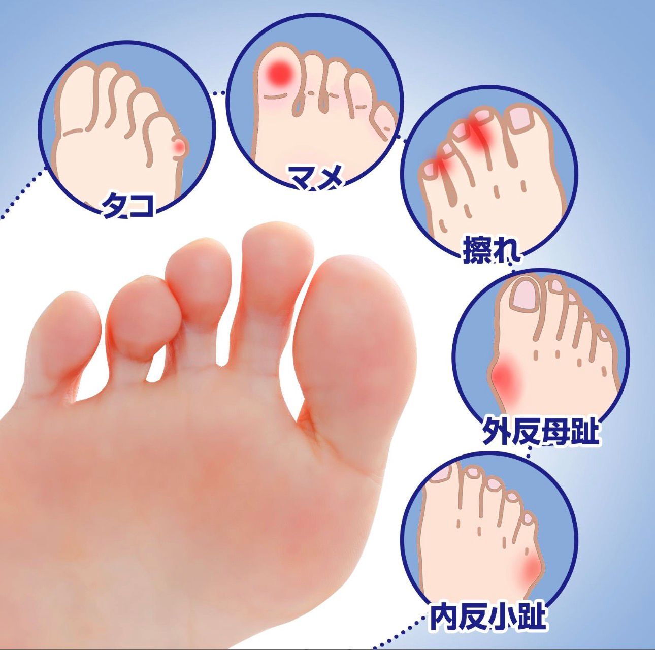 【預購】JN0305110 抗菌矽膠足趾保護套