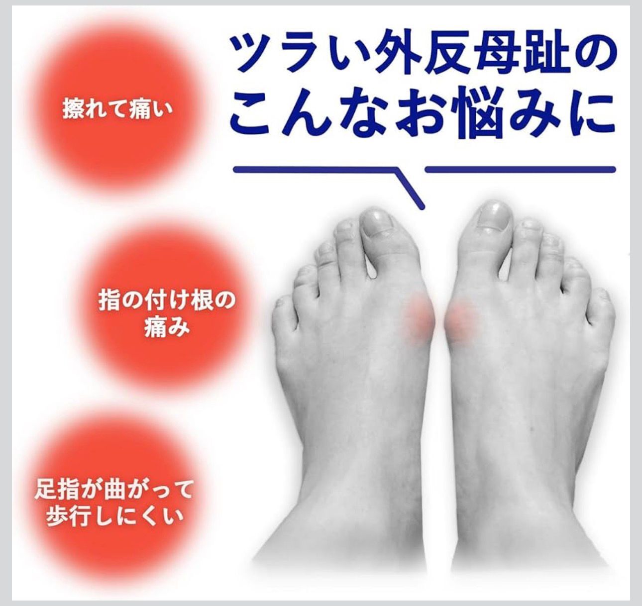 【預購】JN0305111 日本製🇯🇵拇趾外翻（拇囊炎）矯正支撐保護貼 （16件）