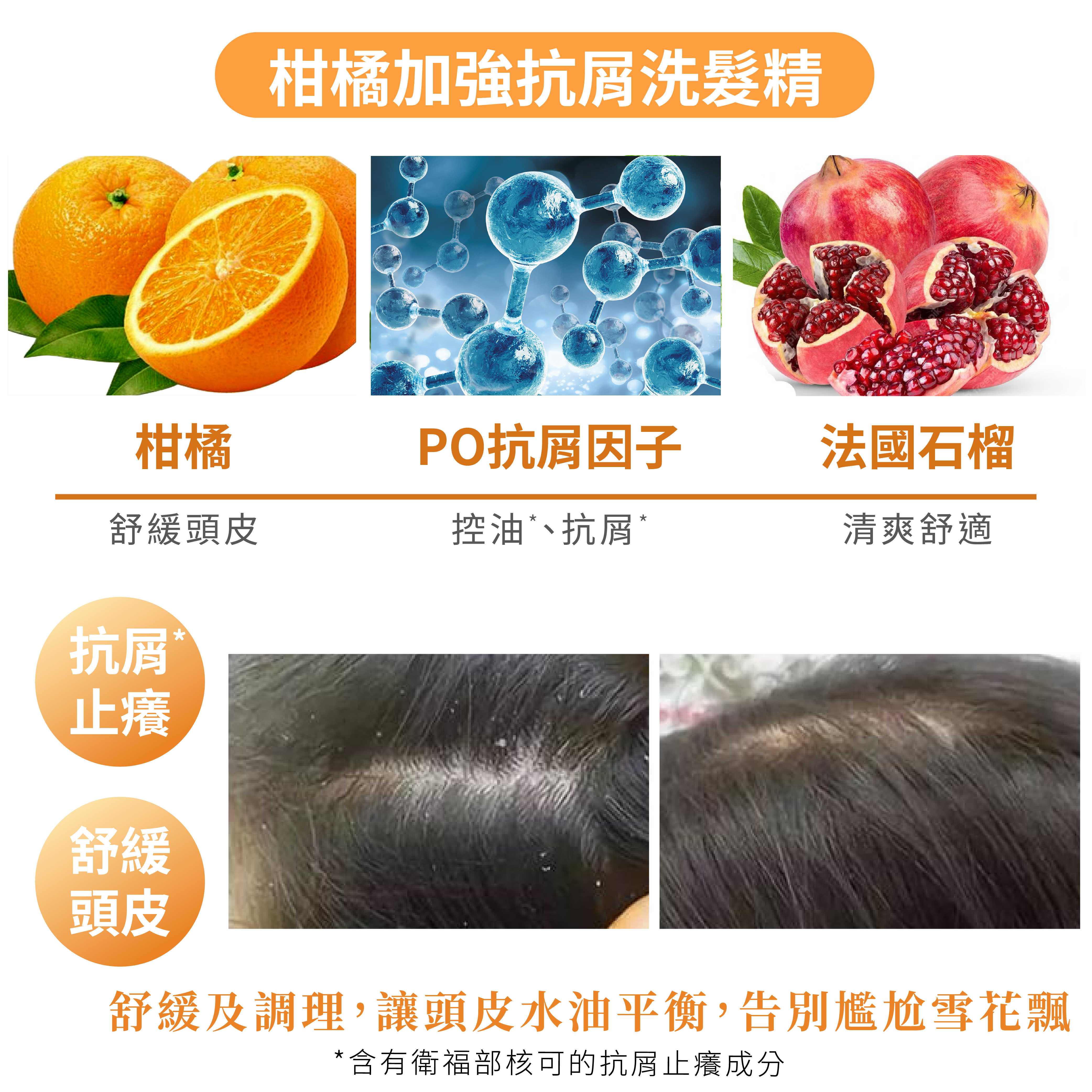 Follimin髮利明洗髮精全系列選購指南 劉紹毅醫師推薦 鋸棕櫚控油 咖啡因蓬鬆 藍銅健髮 茶樹抗屑 黑釉亮護色 功效介紹與正確洗髮步驟