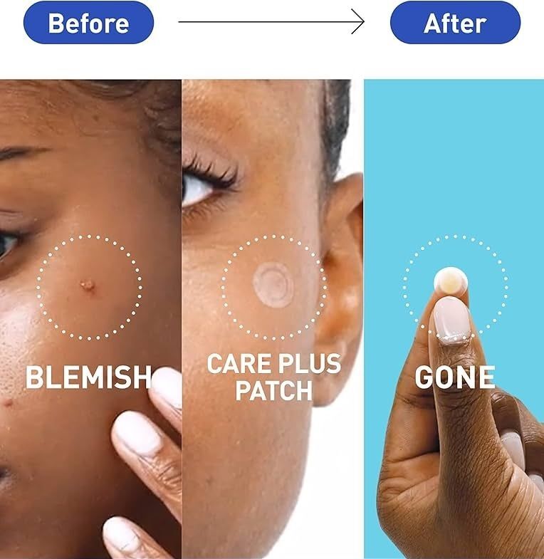 修護隱形痘痘貼102貼 (平行進口)