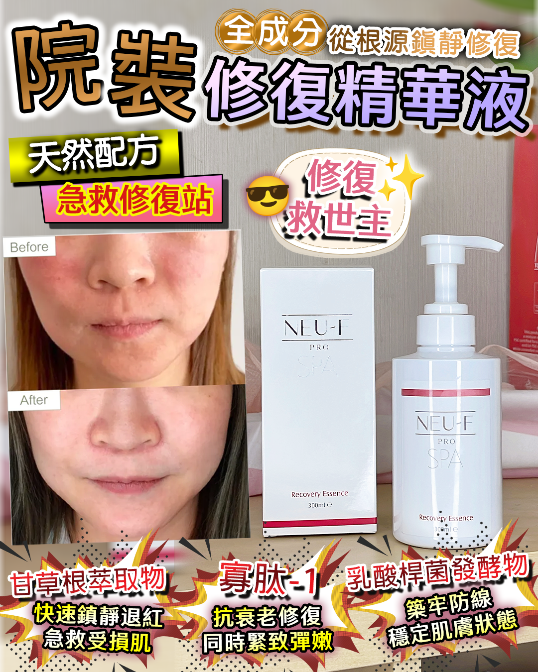 0309BB10-護膚品SKC-Recovery Essence 買一送一，[共兩枝] 送精美納米噴霧樽 1個（A10）