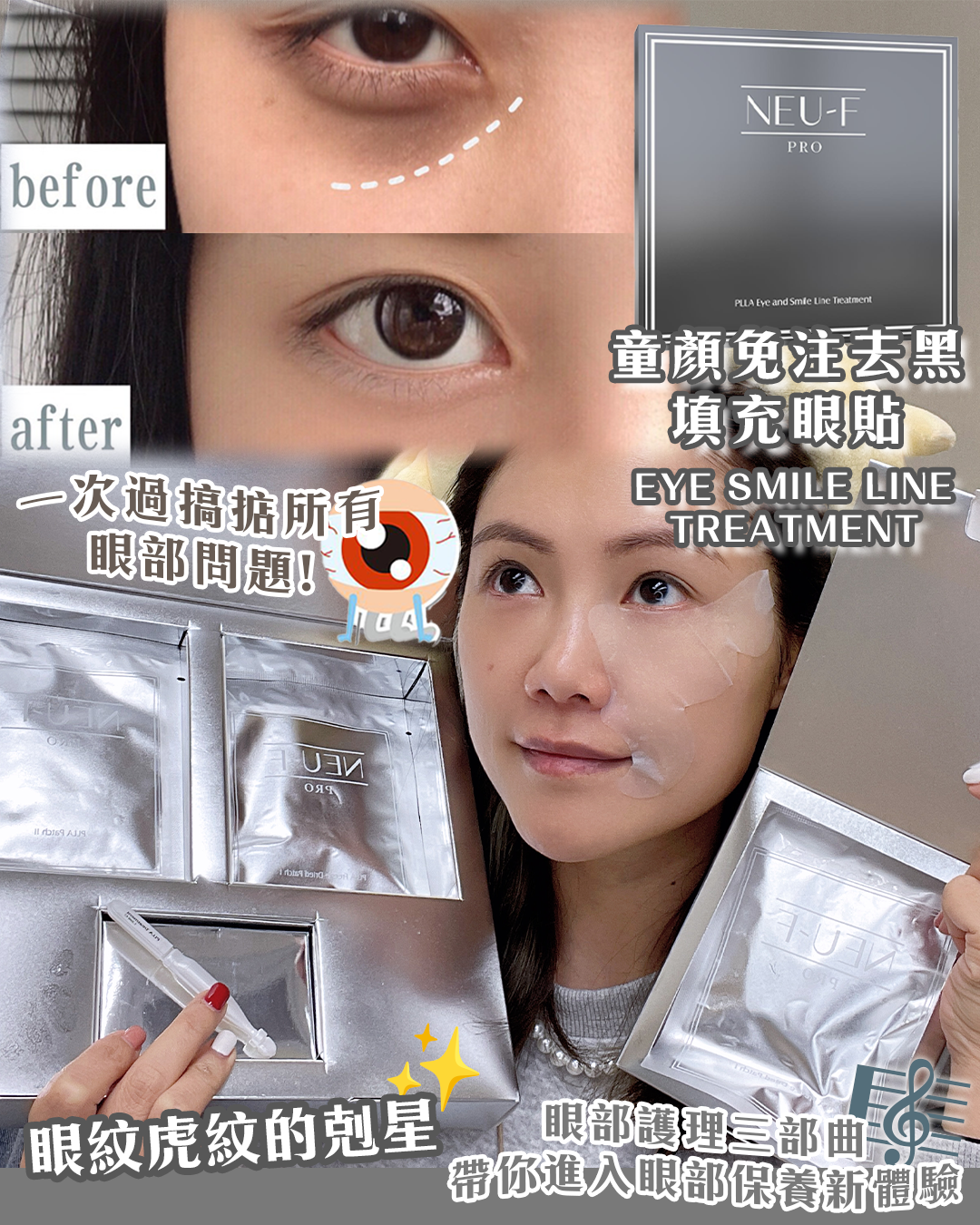 0309BB13-護膚品SKC-PLLA Eye And Smile Line Treatment送PLLA Freeze Dried Patch I 1盒加送Random Mask 5 片（A13）
