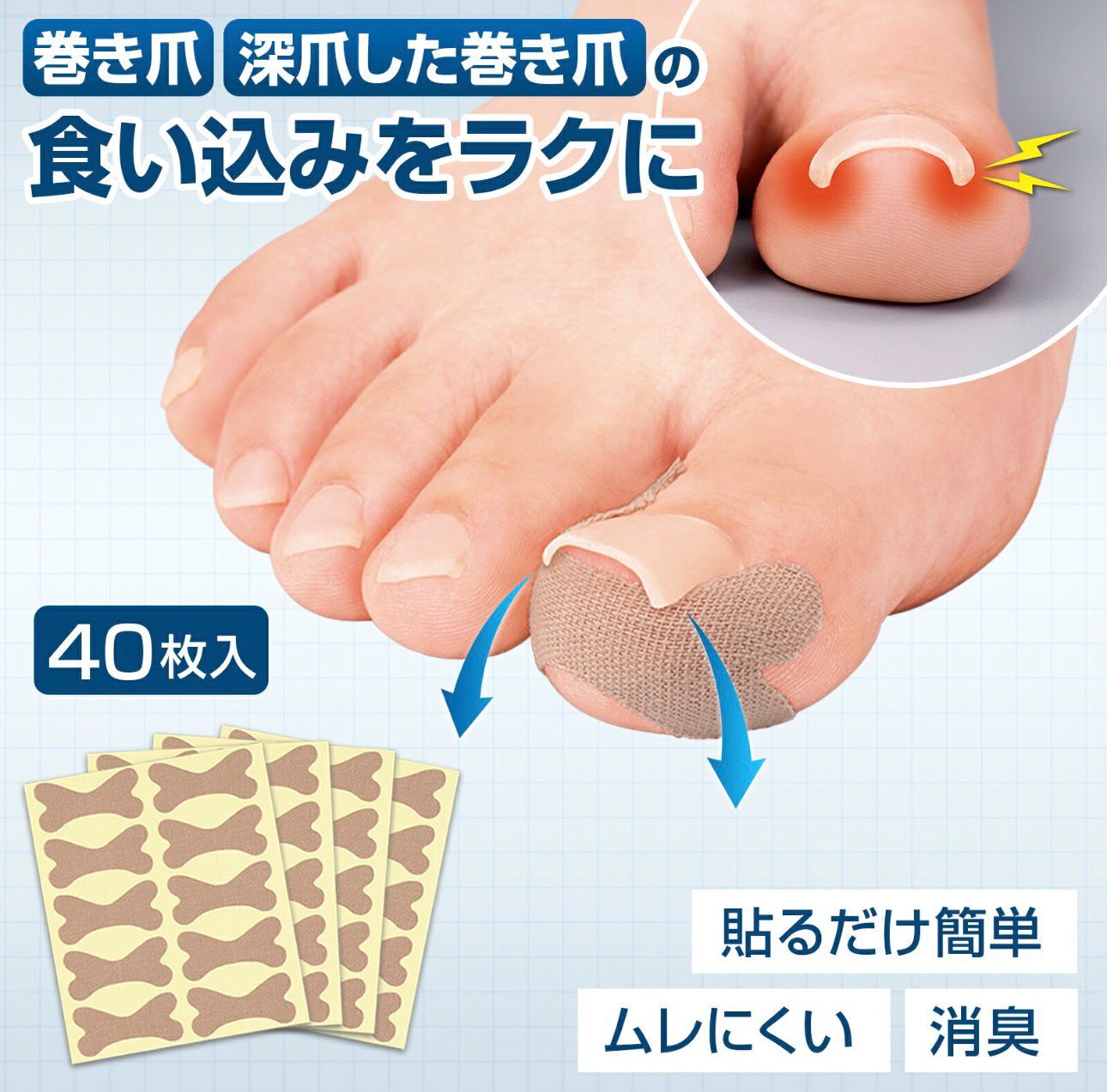 【預購】JN030908 🇯🇵日本製 卷甲輔助貼