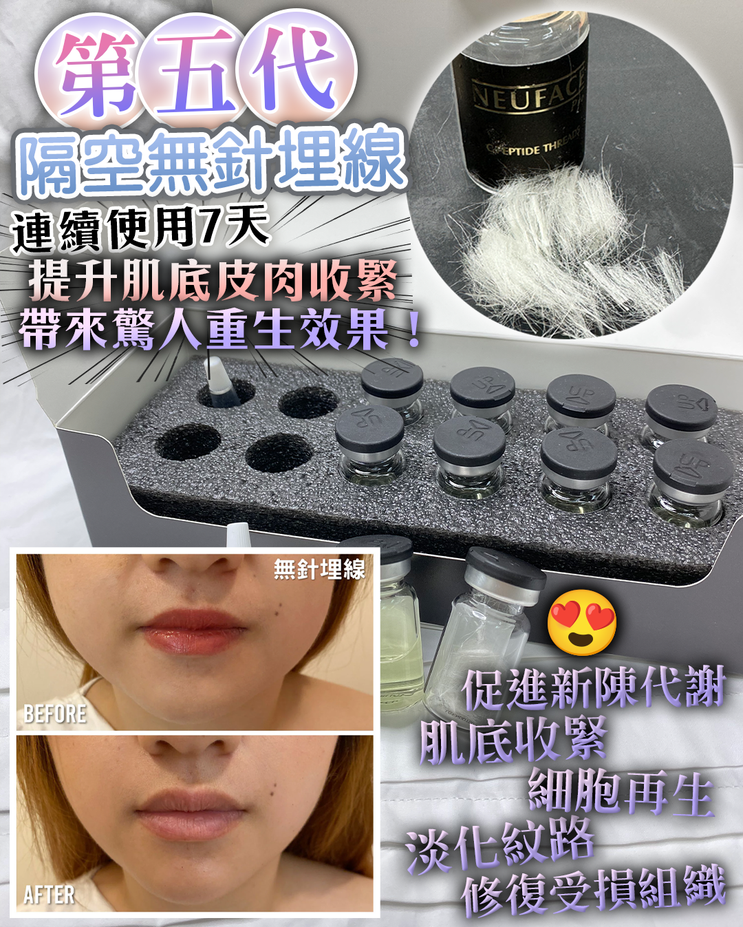 38女神節專屬獨寵祭_ Neu-F Pro Dermthread+ 6盒 送 Random Serum 1枝 + Neuface Pro Gift Mask 10片 +Post-Op Lifting Mask 1枝