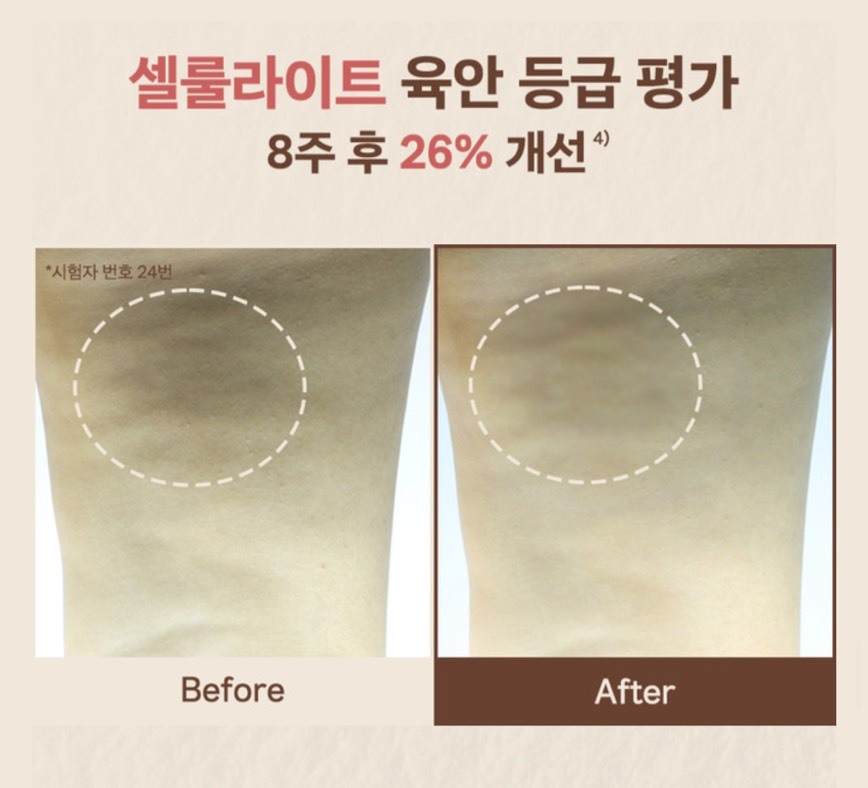 韓國Nutseline身體刮痧保濕精華 60ml