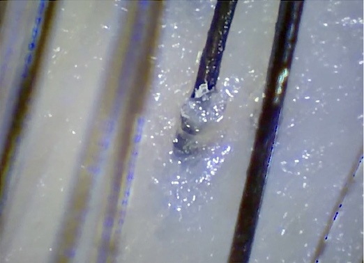 使用前頭皮顯微鏡圖