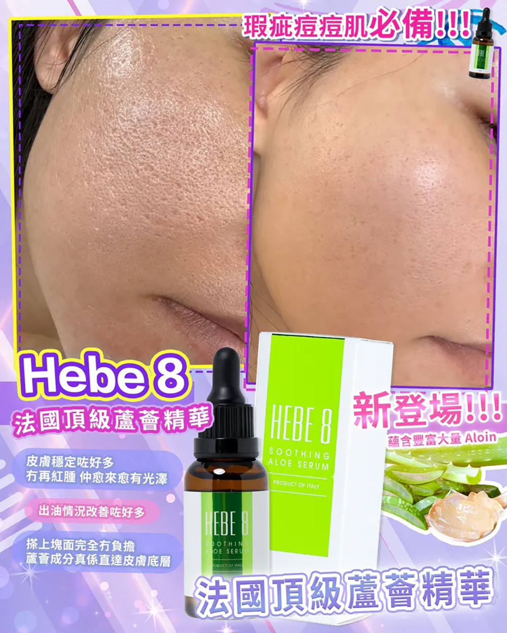 HEBE 8法國頂級舒敏保濕精華30ML