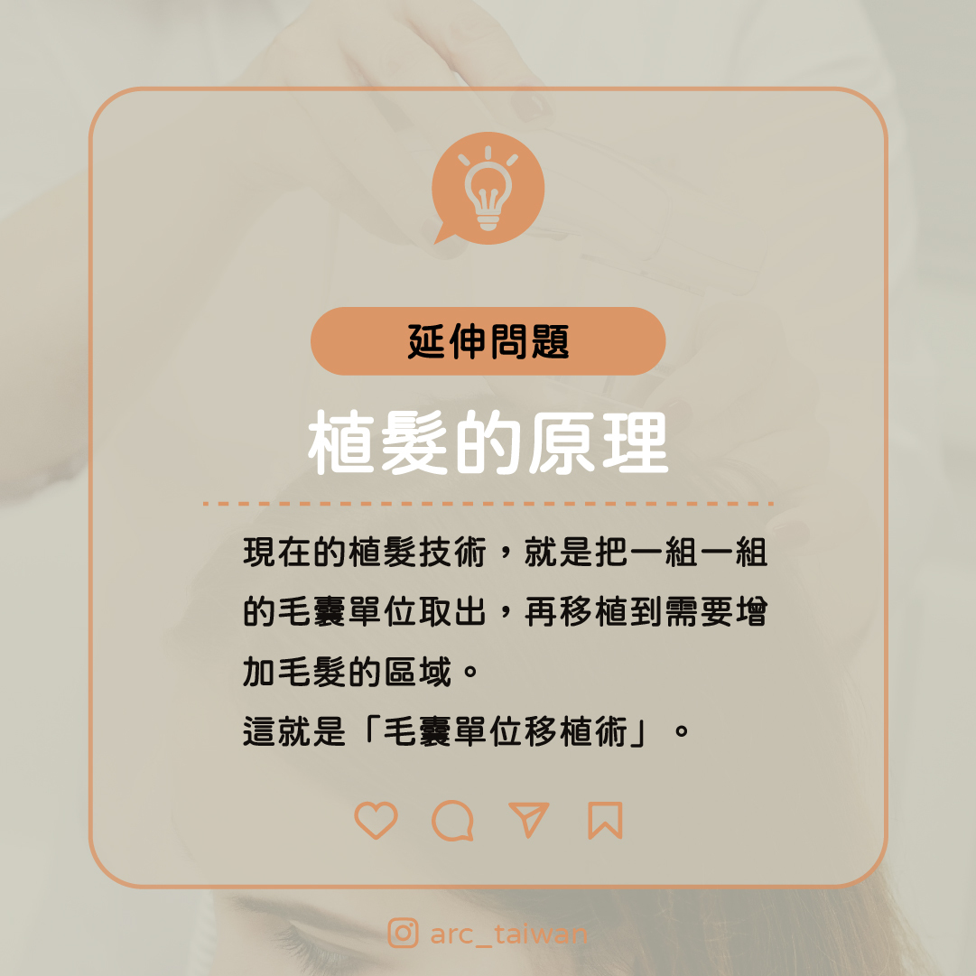 植髮的原理 現在的植髮技術就是把,一組一組的毛囊單位取出,再移植到,需要增加毛髮的區域 這就是 「毛囊單位移植術」