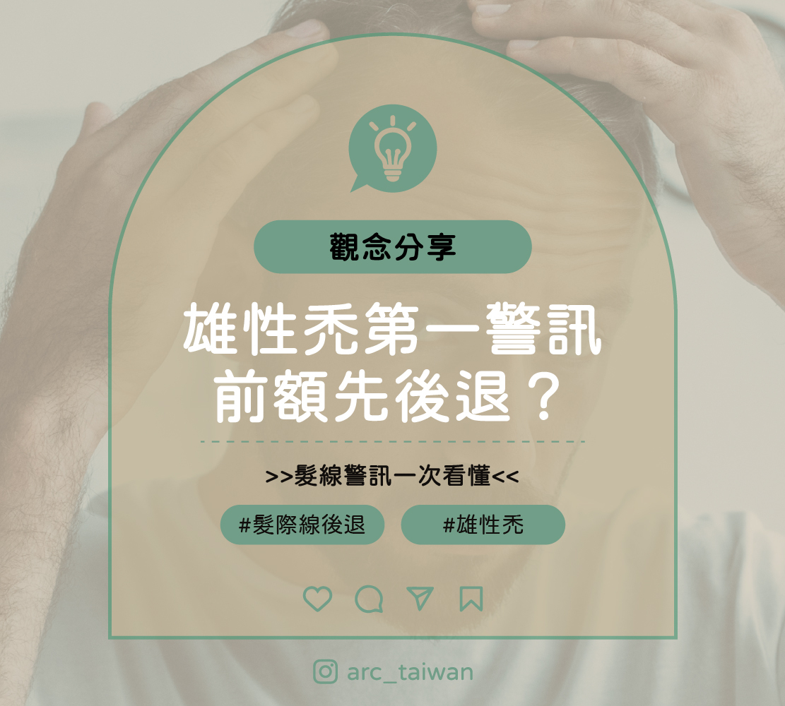 雄性禿第一警訊:前額先後退? 髮線警訊一次看懂 觀念分享 #髮際線後退 #雄性禿
