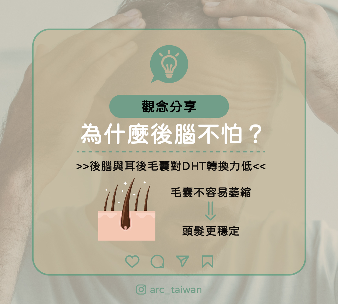 為什麼後腦不怕? 後腦與耳後毛囊對DHT轉換力低 → 毛囊不容易萎縮 → 頭髮更穩定