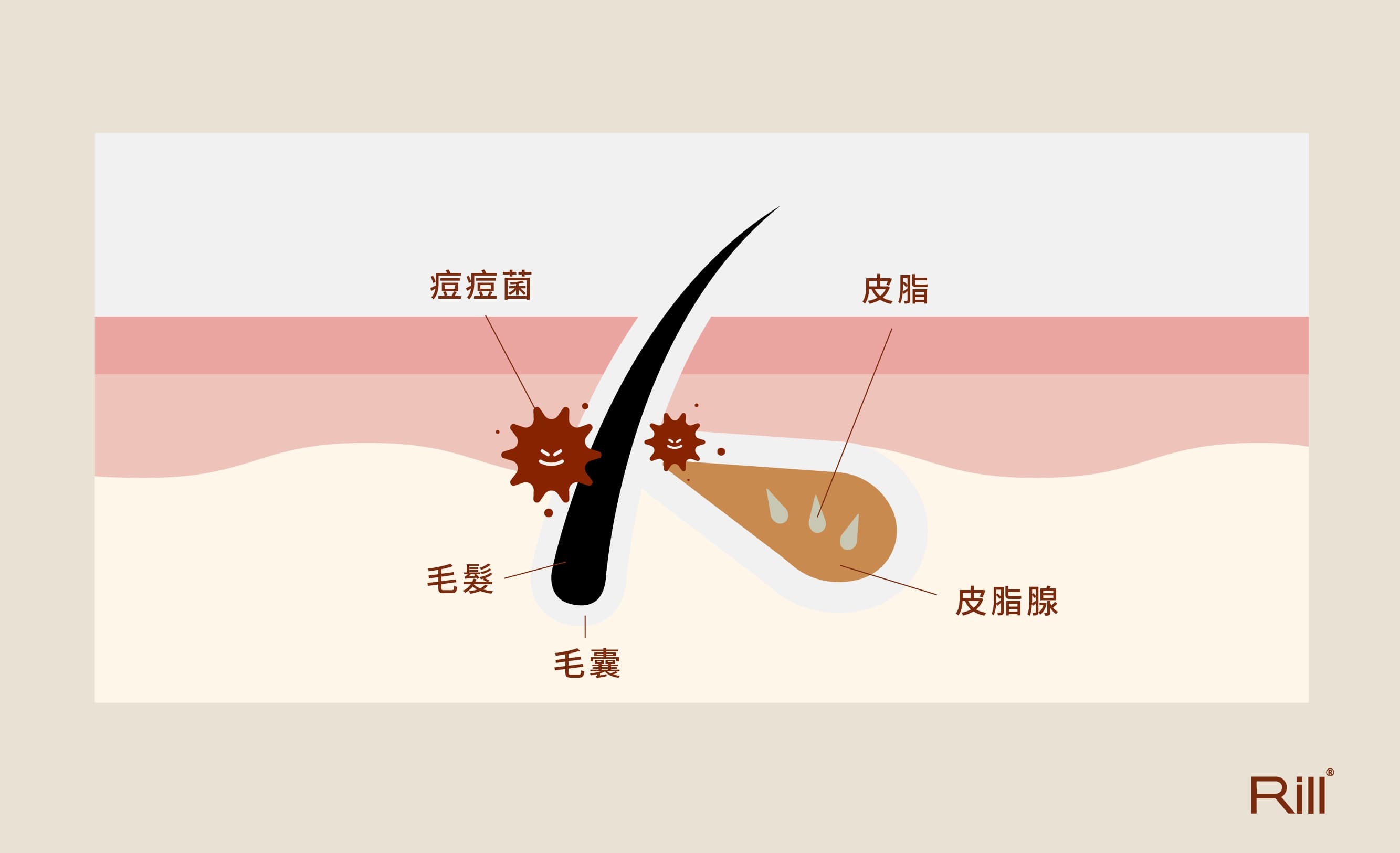 什麼是頭皮出油？毛囊內的皮脂腺產出油性物質，保護頭皮不受外界刺激