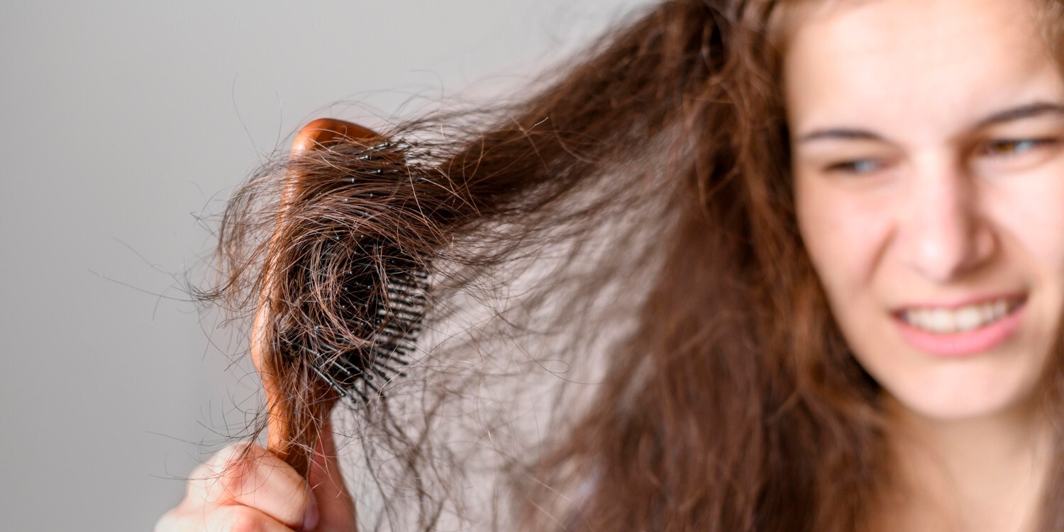 產後狂掉髮怎麼辦?