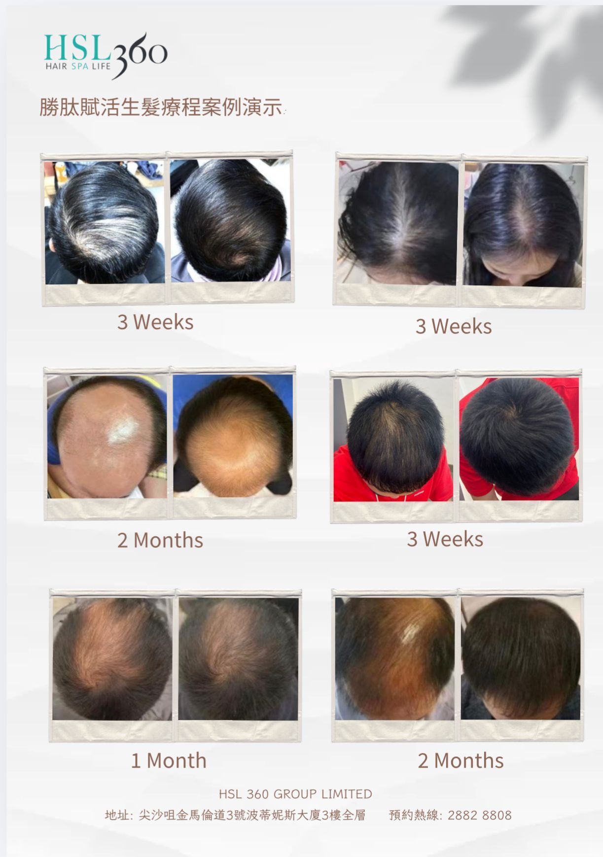 (6853) 勝肽賦活生髮療程