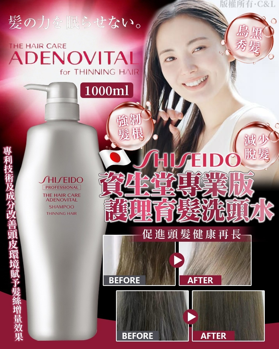 日本Shiseido資生堂專業版護理育髮洗頭水1000ml