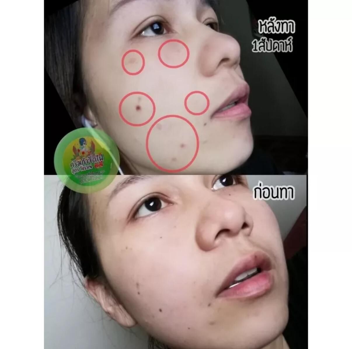 泰國人氣 草本去瘡去疣膏