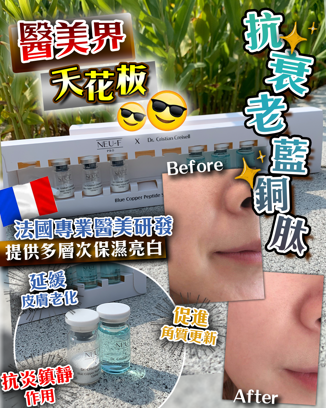 20260318_Neu-F X Dr. Cristian Creixell Blue Copper Peptide Synthesis + VC Antioxidant Synthesis 送 Post-Op Brillance Mask + Random Mask 5pcs