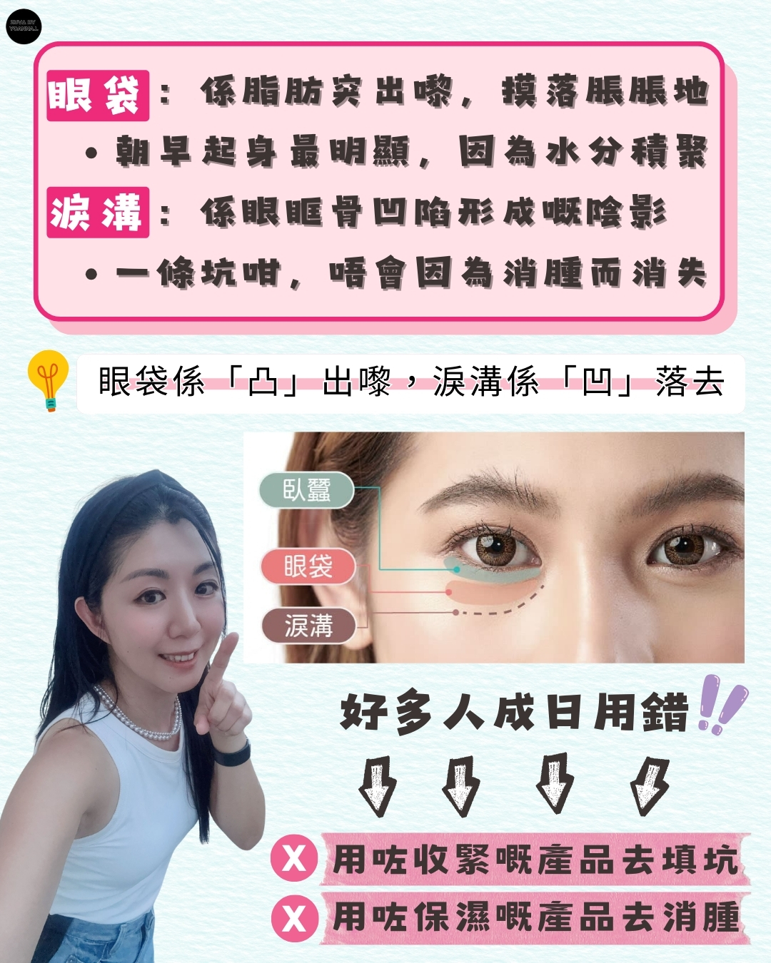 隻眼又腫又凹，究竟係眼袋定淚溝？