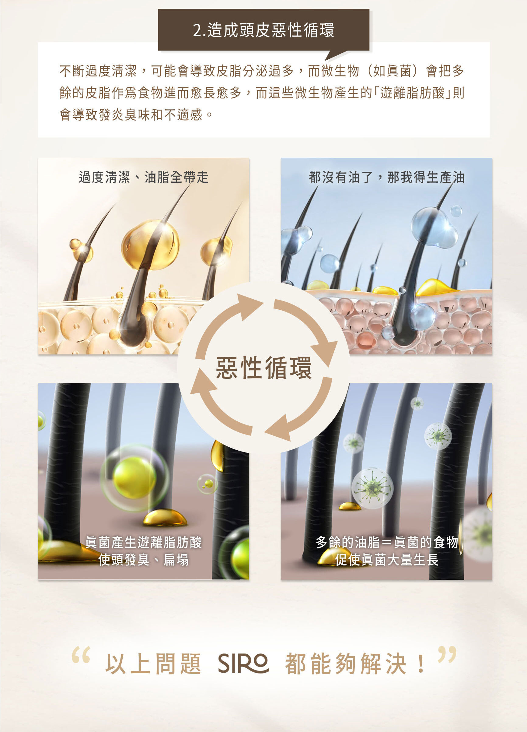 過度清潔會導致皮脂分泌過多，造成惡性循環