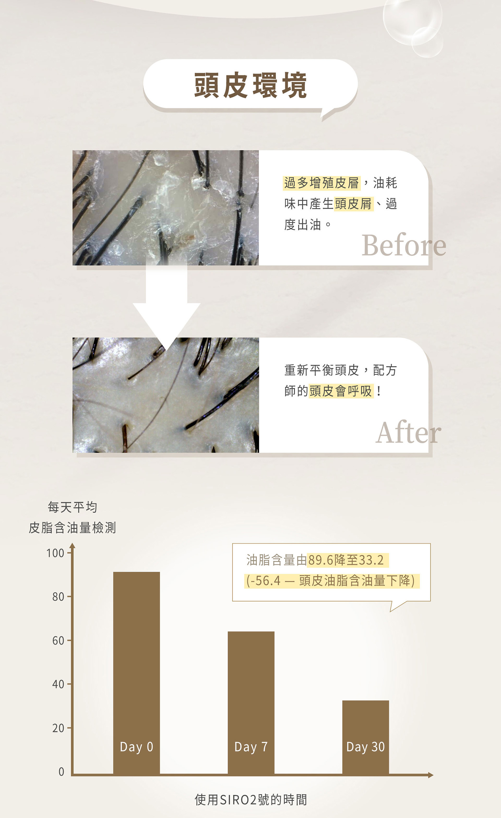 重新平衡頭皮，配方師的頭皮會呼吸