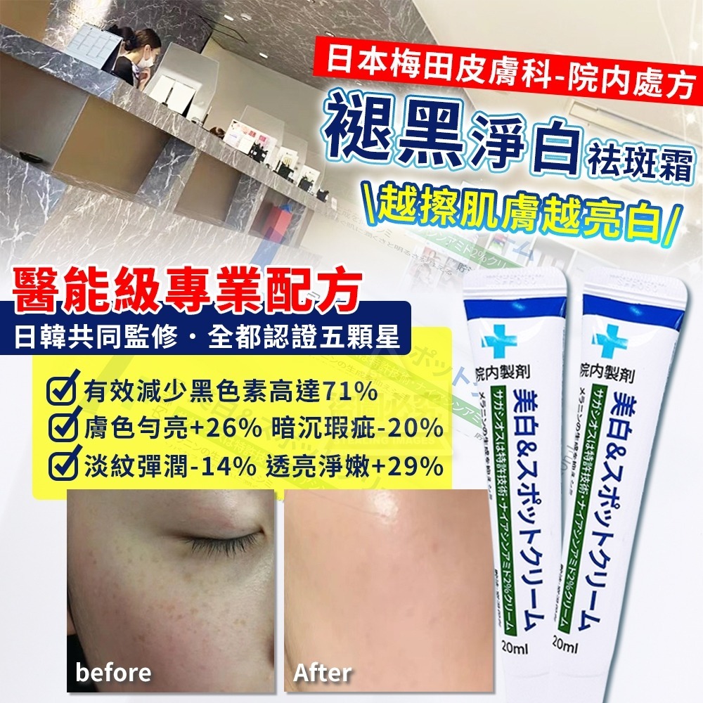 WSBB6145  日本梅田皮膚科-院内處方｜褪黑淨白祛斑霜20ml（5月底）