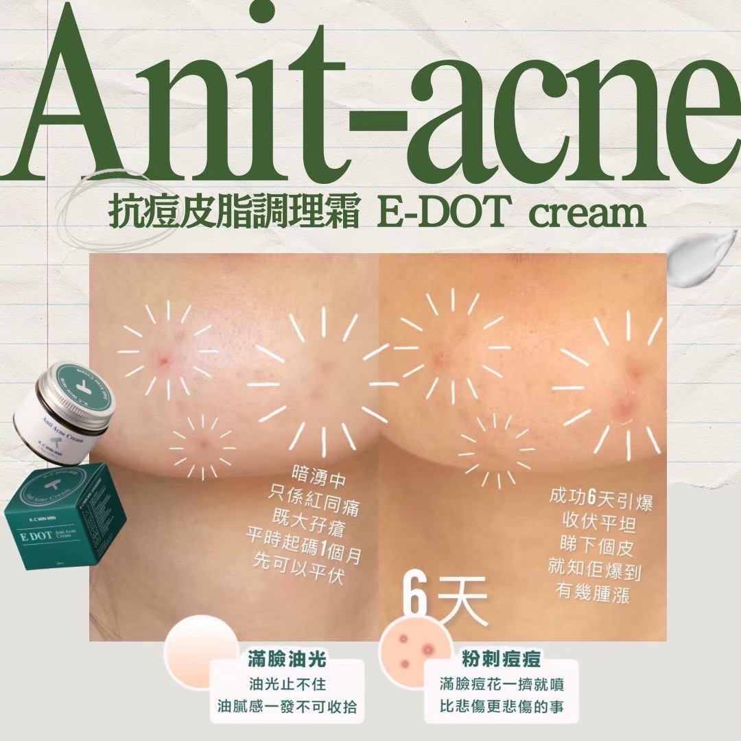 抗痘皮脂調理霜