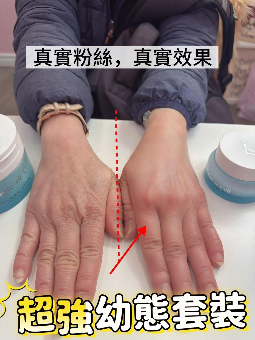 Beauté de Cell 幼態霜 / 幼態膜 T94  (2-3星期寄出)