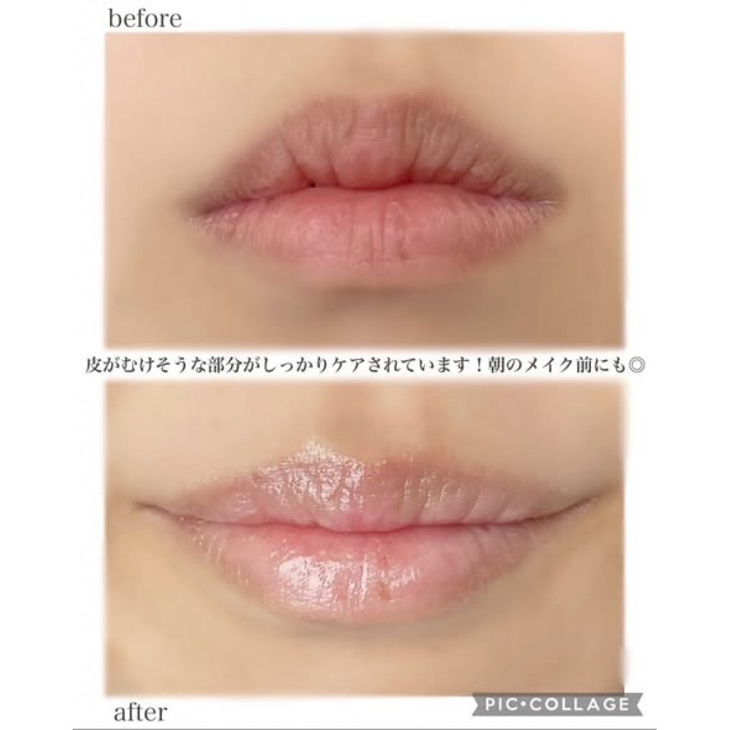 (預購商品) Dr.Reju-All PDRN 極致修護護唇精華-10ml