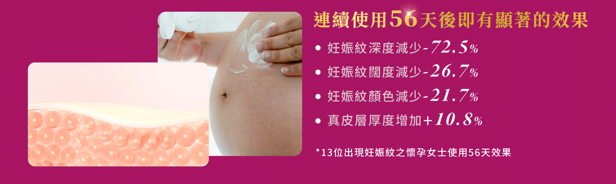Maternea 防妊娠紋霜使用56天臨床成效，減淡妊娠紋深度72.5%，改善肌膚厚度10.8%。