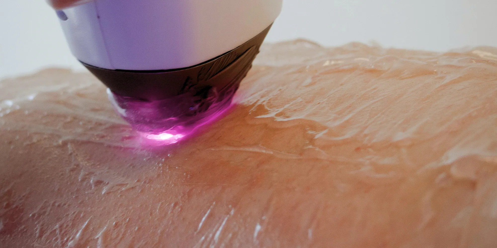 孕婦為什麼需要除毛?