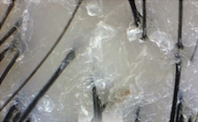 使用前頭皮環境