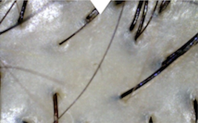 使用後頭皮環境