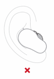 耳塞導致壓力過大