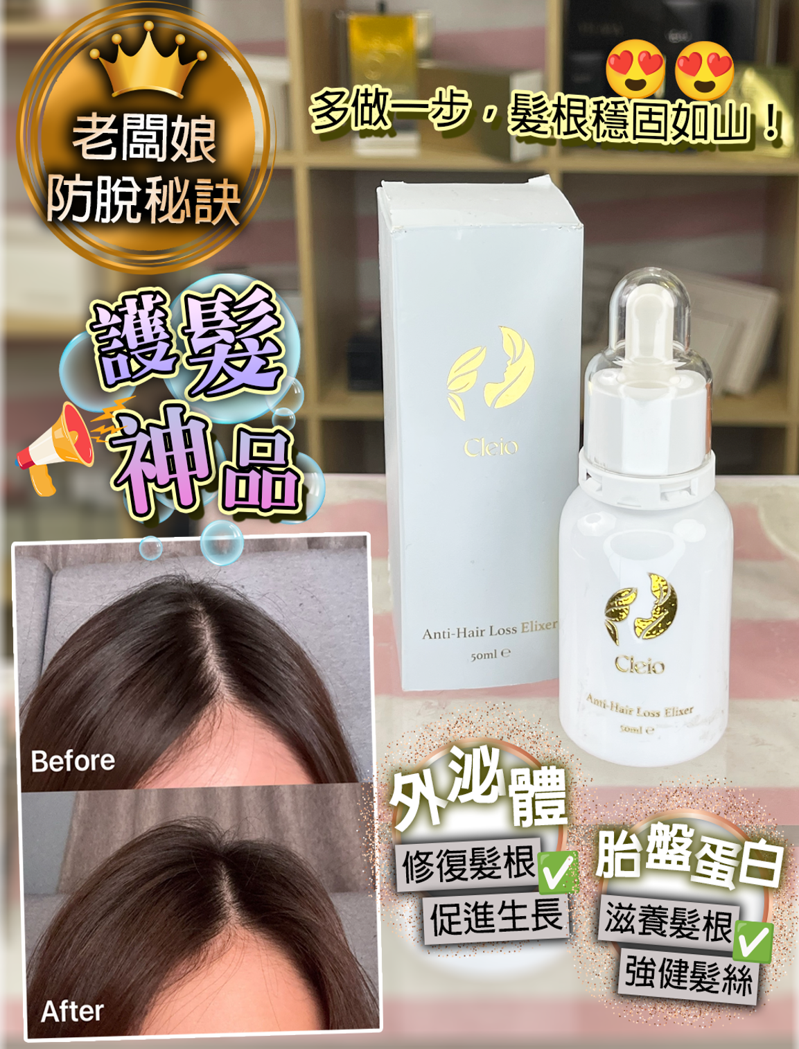 0326PE14-美顏PE-Anti-Hair Loss Elixer 50ml [1盒] + Hair Growth Elixer 50ml [1盒] 送 Random Mask [10片] (A14)