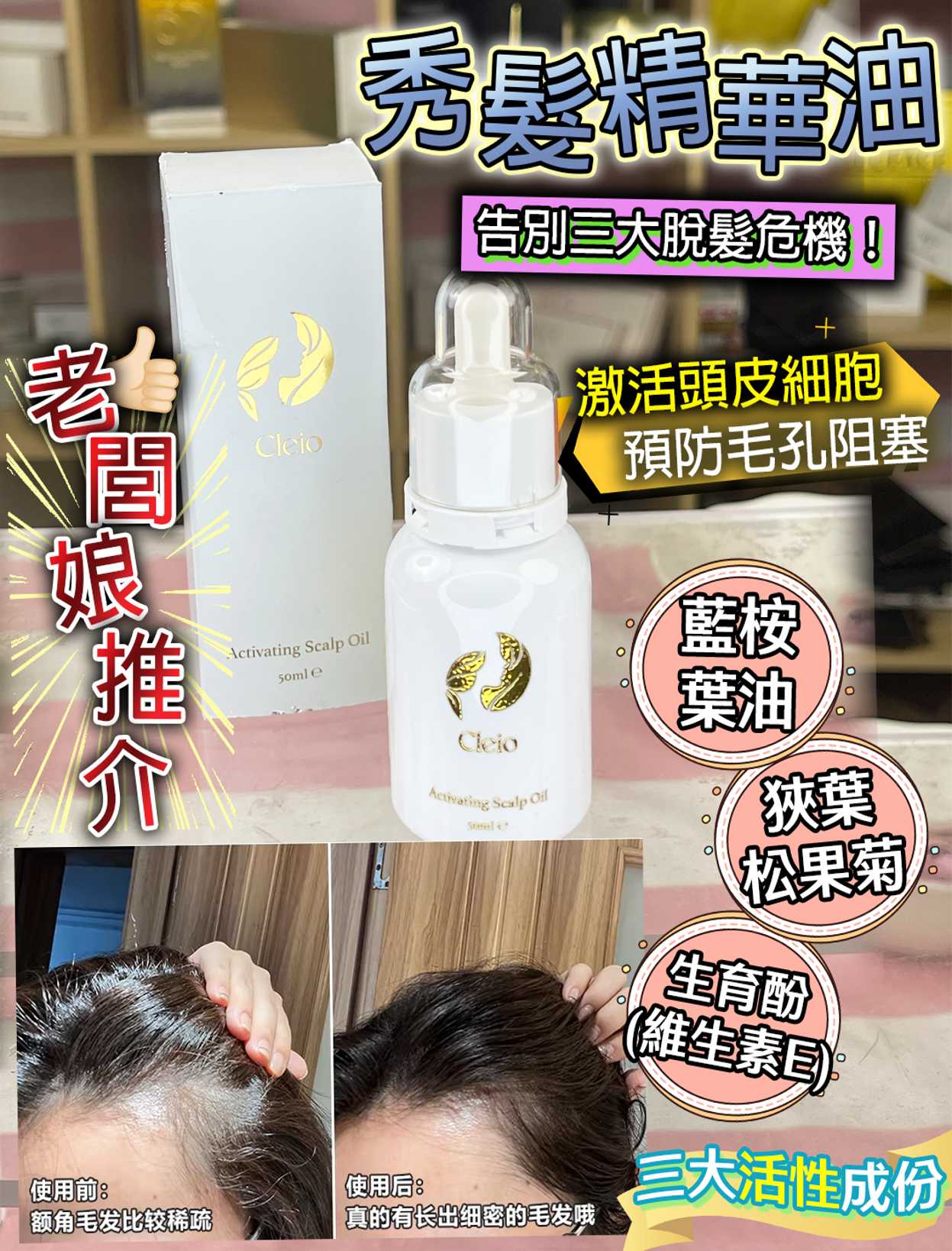 0326PE15-美顏PE-Activating Scalp Oil 50ml + Stemcell Vita Booster 50ml 送 Random Mask [10片] (A15)