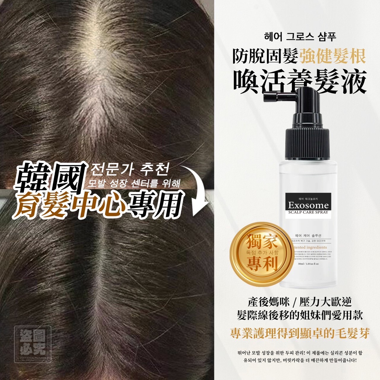 WSBB8994  🔥韓國 外祕體系列頭皮護理噴霧（5月底）