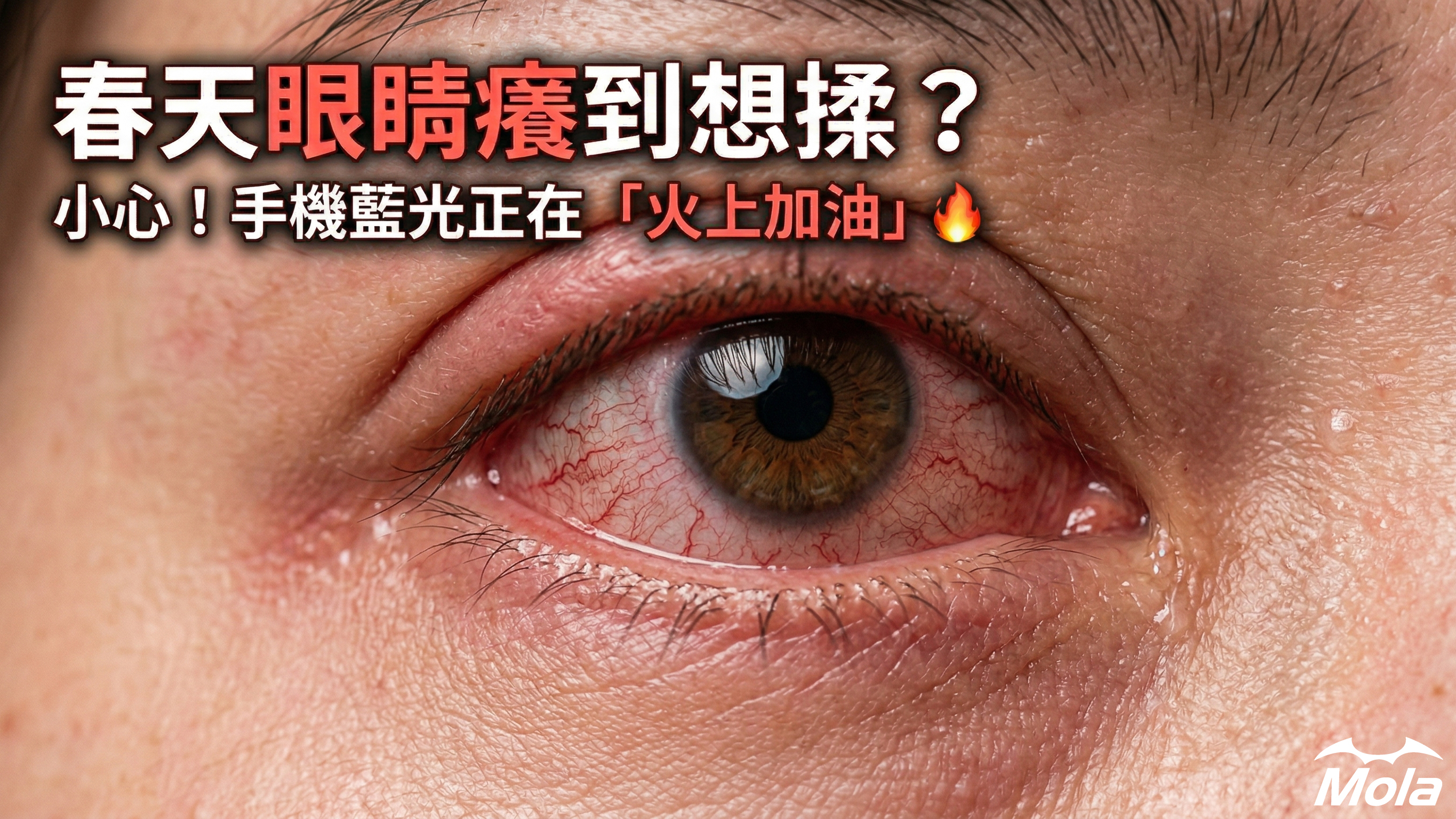 春天眼睛癢?專家:除了點藥水,眼鏡族更需要「濾藍光減壓」防護 | MOLA 摩拉
