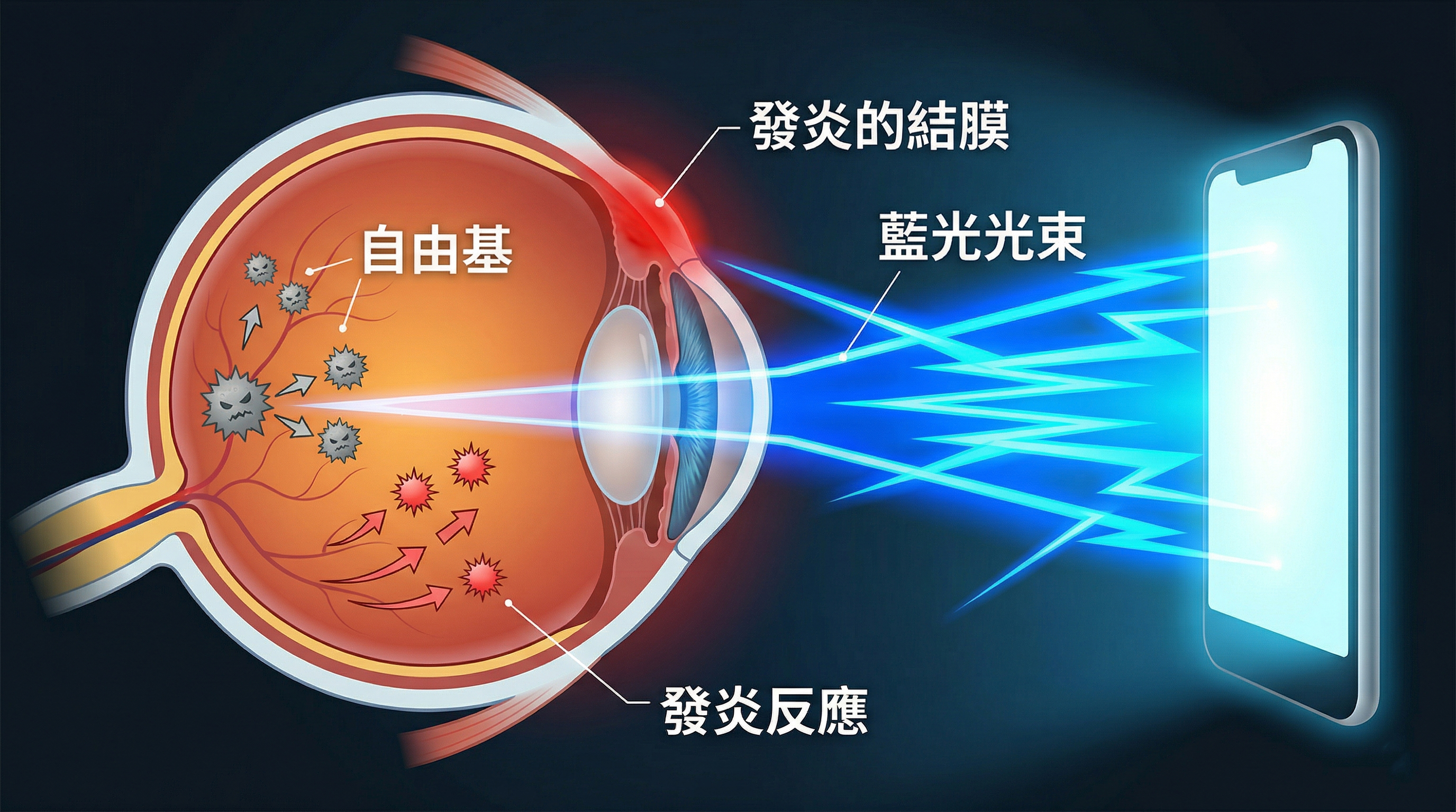 春天眼睛癢?專家:除了點藥水,眼鏡族更需要「濾藍光減壓」防護 | MOLA 摩拉