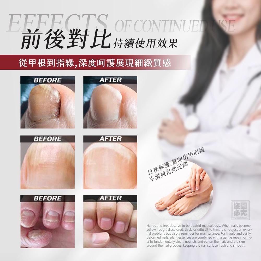 WSBA9559  台灣製造灰指甲滋養膏15ml（6月上旬）