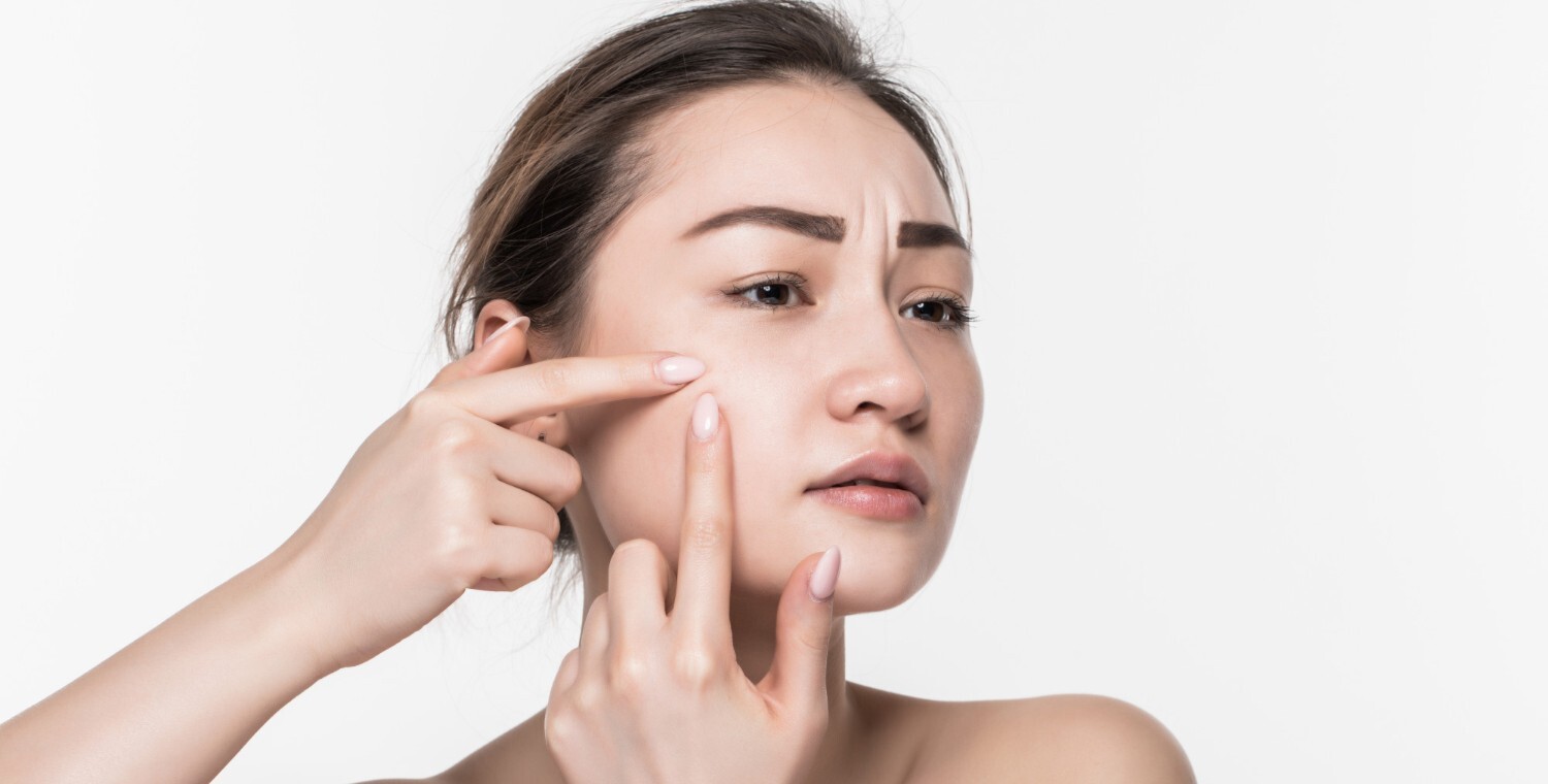 吃膠原蛋白會長痘痘嗎