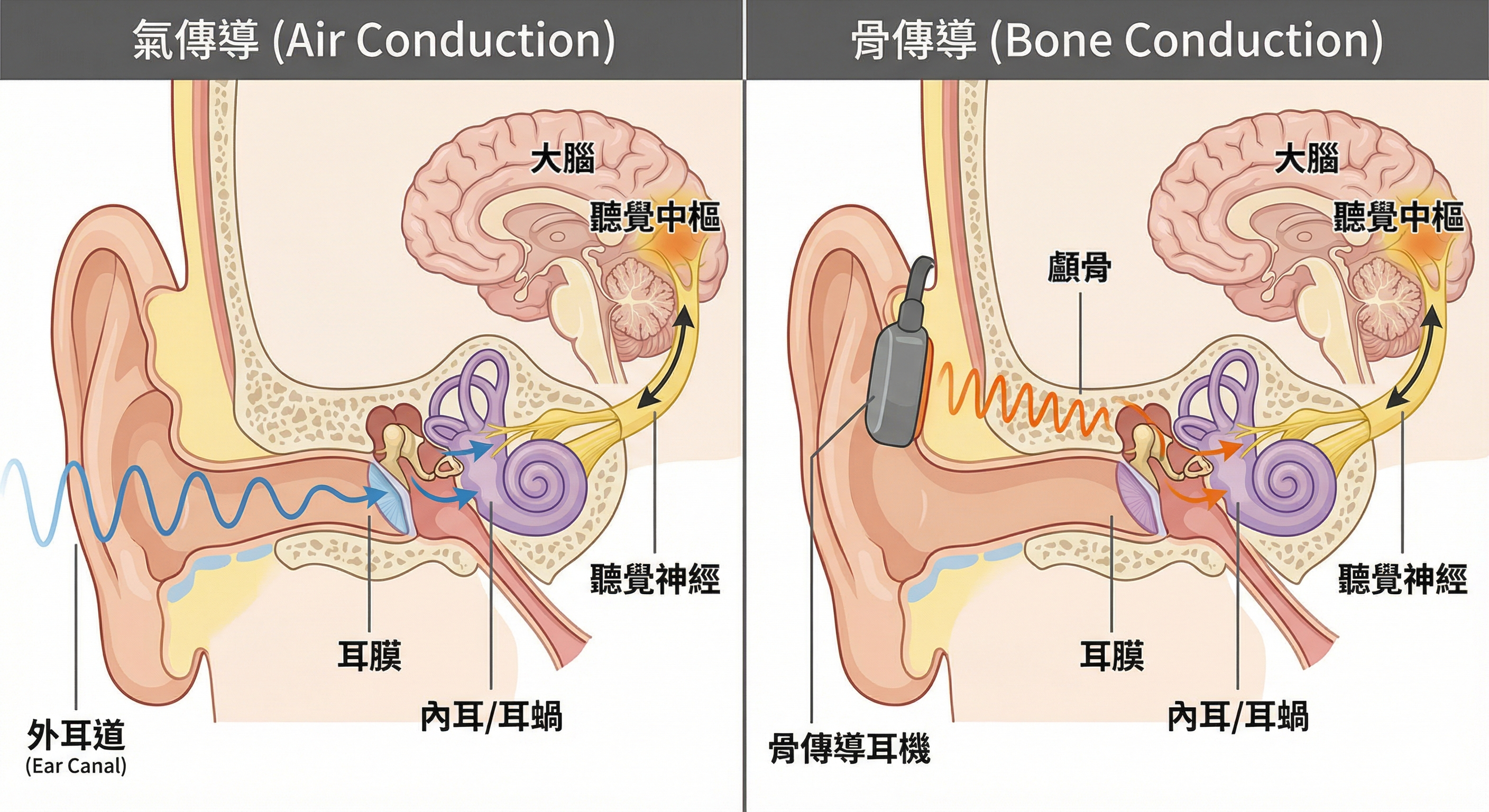 骨傳導與氣傳導的聽覺聲波路徑示意圖