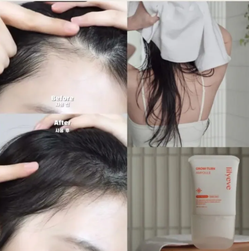 lilyeve - 防脫髮外泌體安瓶精華Grow Turn Ampoule Set