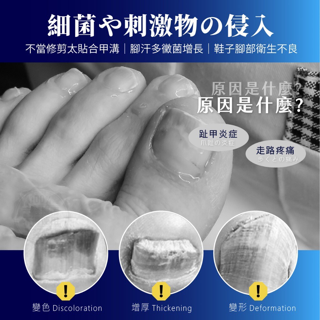 日本アシノセンセイ® 灰甲修護貼 21貼/盒