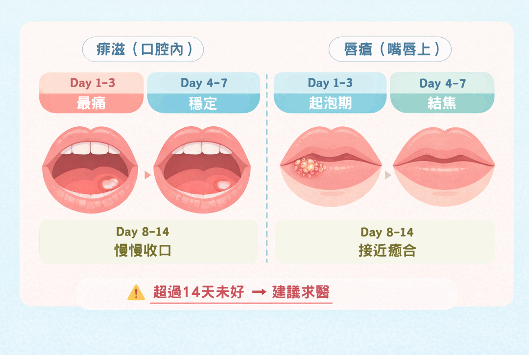 痱滋與唇瘡恢復時間示意圖,展示1至14日不同階段變化