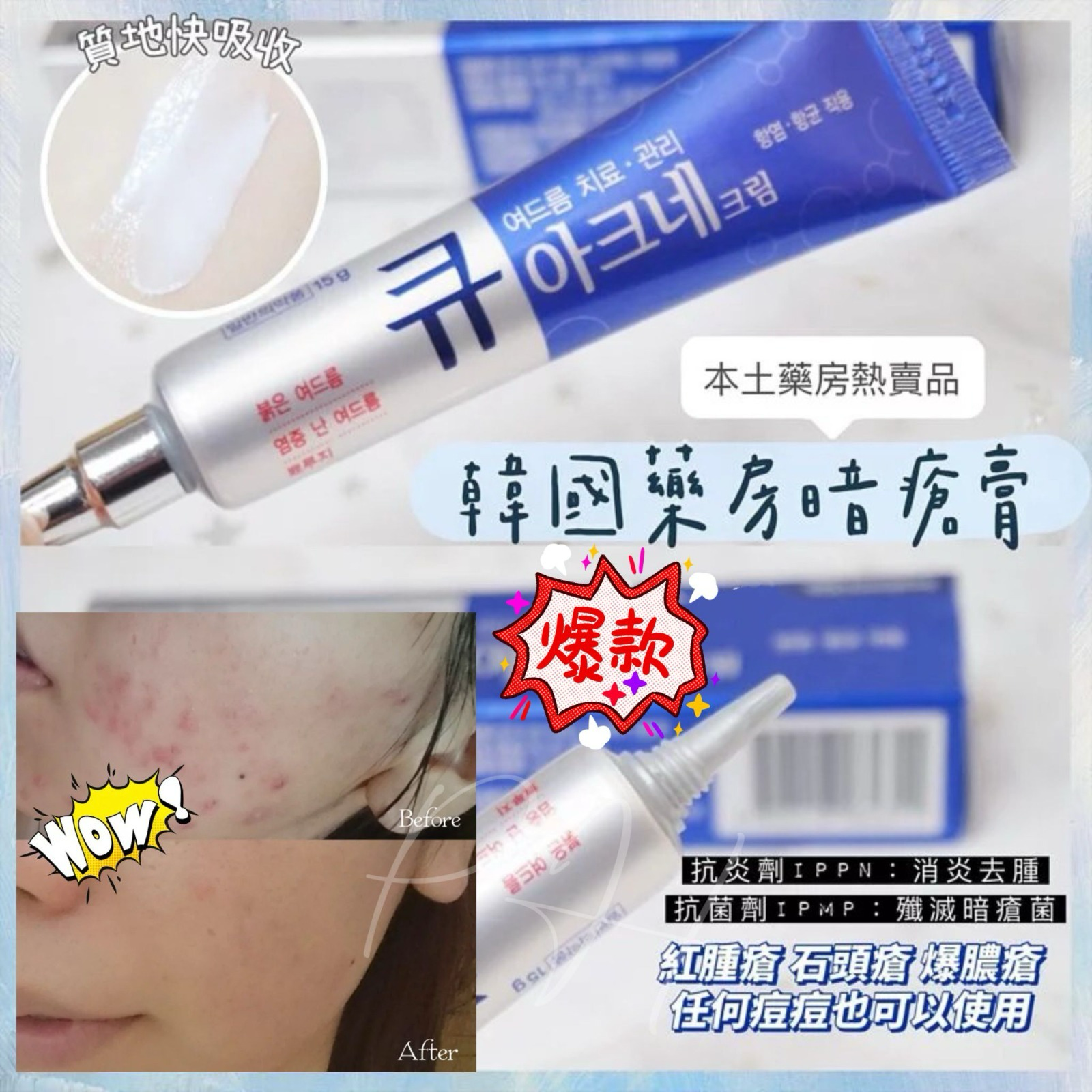 S21224 韓國本土藥房熱賣 Q Acne祛痘消炎暗瘡膏15g